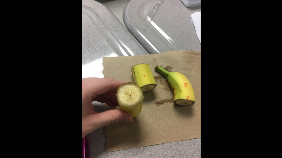 Banana Autopsy Awakened Omniscience