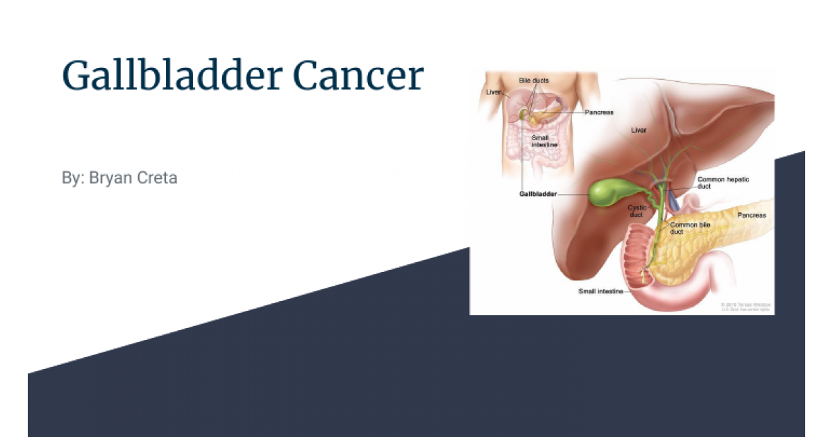 gallbladder cancer research paper